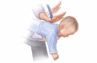 8 kỹ năng cấp cứu cơ bản ai cũng nên biết